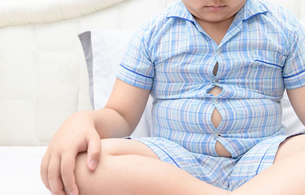 Thừa cân, béo phì ở trẻ em – Có phải càng bụ bẫm càng tốt?