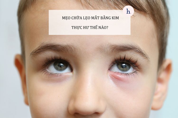 Những trường hợp nên điều trị lẹo mắt bằng phương pháp truyền thống giữa các bác sĩ?